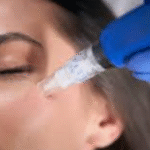 Microneedling at Home: Unlocking the Secrets to Youthful Skin