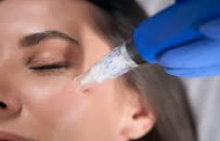 Microneedling at Home: Unlocking the Secrets to Youthful Skin